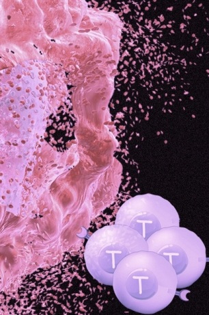 شیمی درمانی